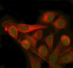 Immunofluorescent staining of PMM2 using anti-PMM2 antibody (green) and anti-Beta Tubulin antibody (red). PMM2 was detected in immunocytochemical section of HELA cell. Enzyme antigen retrieval was performed using IHC enzyme antigen retrieval reagent for 15 mins. The cells were blocked with 10% goat serum. And then incubated with 5 ug/ml rabbit anti-PMM2 antibody and mouse anti-Beta Tubulin antibody overnight at 4oC. DyLight 488 Conjugated Goat Anti-Rabbit IgG and Cy3 Conjugated Goat Anti-Mouse IgG were used as secondary antibody at 1:500 dilution and incubated for 30 minutes at 37oC. Visualize using a fluorescence microscope and filter sets appropriate for the label used.