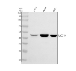 Western blot analysis of RAD51B using anti-RAD51B antibody. Electrophoresis was performed on a 10% SDS-PAGE gel at 80V (Stacking gel) / 120V (Resolving gel) for 2 hours. Lane 1: human Jurkat whole cell lysates, Lane 2: human Hacat whole cell lysates, Lane 3: human U20S whole cell lysates. After electrophoresis, proteins were transferred to a nitrocellulose membrane at 150 mA for 50-90 minutes. Blocked the membrane with 5% non-fat milk/TBS for 1.5 hour at RT. The membrane was incubated with rabbit anti-RAD51B antibody at 0.5 ug/ml overnight at 4oC, then washed with TBS-0.1%Tween 3 times with 5 minutes each and probed with a goat anti-rabbit IgG-HRP secondary antibody at a dilution of 1:5000 for 1.5 hour at RT. The signal was developed using an ECL Plus Western Blotting Substrate. The expected molecular weight of RAD51B is ~42 kDa.