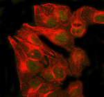 Immunofluorescent staining of RAD51B using anti-RAD51B antibody (green) and anti-Beta Tubulin antibody (red). RAD51B was detected in an immunocytochemical section of U2OS cells. Enzyme antigen retrieval was performed using IHC enzyme antigen retrieval reagent for 15 mins. The cells were blocked with 10% goat serum. And then incubated with 5 ug/ml rabbit anti-RAD51B antibody and mouse anti-Beta Tubulin antibody overnight at 4oC. DyLight 488 Conjugated Goat Anti-Rabbit IgG and Cy3 Conjugated Goat Anti-Mouse IgG were used as secondary antibody at 1:500 dilution and incubated for 30 minutes at 37oC. Visualize using a fluorescence microscope and filter sets appropriate for the label used.