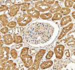Immunohistochemical staining of DDC using anti-DDC antibody. DDC was detected in a paraffin-embedded section of human kidney tissue. Heat mediated antigen retrieval was performed in EDTA buffer (pH 8.0, epitope retrieval solution). The tissue section was blocked with 10% goat serum. The tissue section was then incubated with 2 ug/ml rabbit anti-DDC antibody overnight at 4oC. Peroxidase Conjugated Goat Anti-rabbit IgG was used as secondary antibody and incubated for 30 minutes at 37oC. The tissue section was developed using an HRP secondary and DAB substrate.