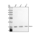 Western blot analysis of POLD4 using anti-POLD4 antibody. Electrophoresis was performed on a 12% SDS-PAGE gel at 80V (Stacking gel) / 120V (Resolving gel) for 2 hours. Lane 1: human whole cell lysates, Lane 2: human THP-1 whole cell lysates, Lane 3: human MCF-7 whole cell lysates. After electrophoresis, proteins were transferred to a nitrocellulose membrane at 150 mA for 50-90 minutes. Blocked the membrane with 5% non-fat milk/TBS for 1.5 hour at RT. The membrane was incubated with rabbit anti-POLD4 antibody at 0.5 ug/ml overnight at 4oC, then washed with TBS-0.1%Tween 3 times with 5 minutes each and probed with a goat anti-rabbit IgG-HRP secondary antibody at a dilution of 1:5000 for 1.5 hour at RT. The signal was developed using an ECL Plus Western Blotting Substrate. The expected molecular weight of POLD4 is ~12 kDa.