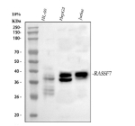 Western blot analysis of RASSF7 using anti-RASSF7 antibody. Lane 1: human HL-60 whole cell lysates, Lane 2: human HepG2 whole cell lysates, Lane 3: human Jurkat whole cell lysates. After electrophoresis, proteins were transferred to a nitrocellulose membrane at 150 mA for 50-90 minutes. Blocked the membrane with 5% non-fat milk/TBS for 1.5 hour at RT. The membrane was incubated with rabbit anti-RASSF7 antibody at 0.5 ug/ml overnight at 4oC, then washed with TBS-0.1%Tween 3 times with 5 minutes each and probed with a goat anti-rabbit IgG-HRP secondary antibody at a dilution of 1:5000 for 1.5 hour at RT. The signal was developed using enhanced chemiluminescent. The expected molecular weight of RASSF7 is 35-40 kDa (multiple isoforms).