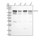 Western blot analysis of TMEM201 using anti-TMEM201 antibody. Lane 1: human 293T whole cell lysates, Lane 2: human Hacat whole cell lysates, Lane 3: human U251 whole cell lysates, Lane 4: human Caco-2 whole cell lysates. After electrophoresis, proteins were transferred to a nitrocellulose membrane at 150 mA for 50-90 minutes. Blocked the membrane with 5% non-fat milk/TBS for 1.5 hour at RT. The membrane was incubated with rabbit anti-TMEM201 antibody at 0.5 ug/ml overnight at 4oC, then washed with TBS-0.1%Tween 3 times with 5 minutes each and probed with a goat anti-rabbit IgG-HRP secondary antibody at a dilution of 1:5000 for 1.5 hour at RT. The signal was developed using enhanced chemiluminescent. Western blot analysis of TMEM201 shows a dominant band at the expected ~72 kDa corresponding to the full-length protein, with several slightly lower bands likely representing differentially glycosylated or processed isoforms commonly observed for nuclear envelope membrane proteins.