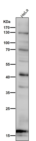 All lanes use the SDHC antibody at 1:6K dilution for 1 hour at room temperature. Predicted molecular weight: 12-19 kDa (multiple isoforms). Bands seen at higher molecular weights may represent SDHC heterodimers.