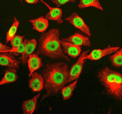 Immunofluorescent staining of RNF220 using anti-RNF220 antibody (green) and anti-Beta Tubulin antibody (red). RNF220 was detected in an immunocytochemical section of Hela cells. Enzyme antigen retrieval was performed using IHC enzyme antigen retrieval reagent for 15 mins. The cells were blocked with 10% goat serum. And then incubated with 5 ug/ml rabbit anti-RNF220 antibody and mouse anti-Beta Tubulin antibody overnight at 4oC. DyLight 488 Conjugated Goat Anti-Rabbit IgG and Cy3 Conjugated Goat Anti-Mouse IgG were used as secondary antibody at 1:500 dilution and incubated for 30 minutes at 37oC. Visualize using a fluorescence microscope and filter sets appropriate for the label used.