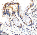 Immunohistochemical staining of EIF3H using anti-EIF3H antibody. EIF3H was detected in a paraffin-embedded section of human colon tissue. Heat mediated antigen retrieval was performed in EDTA buffer (pH 8.0, epitope retrieval solution). The tissue section was blocked with 10% goat serum. The tissue section was then incubated with 2 ug/ml rabbit anti-EIF3H antibody overnight at 4oC. Peroxidase Conjugated Goat Anti-rabbit IgG was used as secondary antibody and incubated for 30 minutes at 37oC. The tissue section was developed using an HRP secondary and DAB substrate.