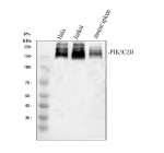 Western blot analysis of PIK3C2B using anti-PIK3C2B antibody. Electrophoresis was performed on a 8% SDS-PAGE gel at 80V (Stacking gel) / 120V (Resolving gel) for 2 hours. Lane 1: human placenta tissue lysates, Lane 2: mouse thymus tissue lysates. After electrophoresis, proteins were transferred to a nitrocellulose membrane at 150 mA for 50-90 minutes. Blocked the membrane with 5% non-fat milk/TBS for 1.5 hour at RT. The membrane was incubated with rabbit anti-PIK3C2B antibody at 0.5 ug/ml overnight at 4oC, then washed with TBS-0.1%Tween 3 times with 5 minutes each and probed with a goat anti-rabbit IgG-HRP secondary antibody at a dilution of 1:5000 for 1.5 hour at RT. The signal was developed using an ECL Plus Western Blotting Substrate. The dominant banding around ~160â180 kDa likely corresponds to fullâlength PIK3C2B with variable post-translational modification and possibly partial degradation or isoform heterogeneity.