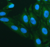 Immunofluorescent staining of FFPE human U-2 OS cells with LRRC40 antibody (green) and DAPI nuclear stain (blue). HIER: steam section in pH6 citrate buffer for 20 min.