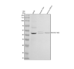 Western blot analysis of TNFRSF10D using anti-TNFRSF10D antibody. Electrophoresis was performed on a 10% SDS-PAGE gel at 80V (Stacking gel) / 120V (Resolving gel) for 2 hours. Lane 1: human whole cell lysates, Lane 2: mouse liver tissue lysates, Lane 3: mouse kidney tissue lysates. After electrophoresis, proteins were transferred to a nitrocellulose membrane at 150 mA for 50-90 minutes. Blocked the membrane with 5% non-fat milk/TBS for 1.5 hour at RT. The membrane was incubated with rabbit anti-TNFRSF10D antibody at 0.5 ug/ml overnight at 4oC, then washed with TBS-0.1%Tween 3 times with 5 minutes each and probed with a goat anti-rabbit IgG-HRP secondary antibody at a dilution of 1:5000 for 1.5 hour at RT. The signal was developed using an ECL Plus Western Blotting Substrate. The expected molecular weight of TNFRSF10D is ~42 kDa.
