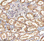 Immunohistochemical staining of TNFRSF10D using anti-TNFRSF10D antibody. TNFRSF10D was detected in a paraffin-embedded section of human kidney tissue. Heat mediated antigen retrieval was performed in EDTA buffer (pH 8.0, epitope retrieval solution). The tissue section was blocked with 10% goat serum. The tissue section was then incubated with 2 ug/ml rabbit anti-TNFRSF10D antibody overnight at 4oC. Peroxidase Conjugated Goat Anti-rabbit IgG was used as secondary antibody and incubated for 30 minutes at 37oC. The tissue section was developed using an HRP secondary and DAB substrate.