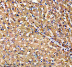 Immunohistochemical staining of TNFRSF10D using anti-TNFRSF10D antibody. TNFRSF10D was detected in a paraffin-embedded section of human liver tissue. Heat mediated antigen retrieval was performed in EDTA buffer (pH 8.0, epitope retrieval solution). The tissue section was blocked with 10% goat serum. The tissue section was then incubated with 2 ug/ml rabbit anti-TNFRSF10D antibody overnight at 4oC. Peroxidase Conjugated Goat Anti-rabbit IgG was used as secondary antibody and incubated for 30 minutes at 37oC. The tissue section was developed using an HRP secondary and DAB substrate.