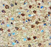 Immunohistochemical staining of SMARCAL1 using anti-SMARCAL1 antibody. SMARCAL1 was detected in a paraffin-embedded section of mouse brain tissue. Heat mediated antigen retrieval was performed in EDTA buffer (pH 8.0, epitope retrieval solution). The tissue section was blocked with 10% goat serum. The tissue section was then incubated with 2 ug/ml rabbit anti-SMARCAL1 antibody overnight at 4oC. Peroxidase Conjugated Goat Anti-rabbit IgG was used as secondary antibody and incubated for 30 minutes at 37oC. The tissue section was developed using an HRP secondary and DAB substrate.