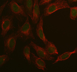 Immunofluorescent staining of MAN2C1 using anti-MAN2C1 antibody (green) and anti-Beta Tubulin antibody (red). MAN2C1 was detected in immunocytochemical section of U2OS cell. Enzyme antigen retrieval was performed using IHC enzyme antigen retrieval reagent for 15 mins. The cells were blocked with 10% goat serum. And then incubated with 5 ug/ml rabbit anti-MAN2C1 antibody and mouse anti-Beta Tubulin antibody overnight at 4oC. DyLight 488 Conjugated Goat Anti-Rabbit IgG and DyLight 594 Conjugated Goat Anti-Mouse IgG were used as secondary antibody at 1:500 dilution and incubated for 30 minutes at 37oC. Visualize using a fluorescence microscope and filter sets appropriate for the label used.