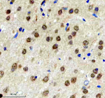 Immunohistochemical staining of BCLAF1 using anti-BCLAF1 antibody. BCLAF1 was detected in a paraffin-embedded section of rat brain tissue. Heat mediated antigen retrieval was performed in EDTA buffer (pH 8.0, epitope retrieval solution). The tissue section was blocked with 10% goat serum. The tissue section was then incubated with 2 ug/ml rabbit anti-BCLAF1 antibody overnight at 4oC. Peroxidase Conjugated Goat Anti-rabbit IgG was used as secondary antibody and incubated for 30 minutes at 37oC. The tissue section was developed using an HRP secondary and DAB substrate.