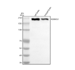 Western blot analysis of IQSEC2 using anti-IQSEC2 antibody. Electrophoresis was performed on a 8% SDS-PAGE gel at 80V (Stacking gel) / 120V (Resolving gel) for 2 hours. Lane 1: rat brain tissue lysates, Lane 2: mouse brain tissue lysates. After electrophoresis, proteins were transferred to a nitrocellulose membrane at 150 mA for 50-90 minutes. Blocked the membrane with 5% non-fat milk/TBS for 1.5 hour at RT. The membrane was incubated with rabbit anti-IQSEC2 antibody at 0.5 ug/ml overnight at 4oC, then washed with TBS-0.1%Tween 3 times with 5 minutes each and probed with a goat anti-rabbit IgG-HRP secondary antibody at a dilution of 1:5000 for 1.5 hour at RT. The signal was developed using an ECL Plus Western Blotting Substrate. IQSEC2 (~163 kDa predicted) was detected at ~200 kDa, consistent with the full-length, phosphorylated form reported in neuronal lysates.