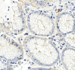 Immunohistochemical staining of OCLN using anti-OCLN antibody. OCLN was detected in a paraffin-embedded section of human stomach tissue. Heat mediated antigen retrieval was performed in EDTA buffer (pH 8.0, epitope retrieval solution). The tissue section was blocked with 10% goat serum. The tissue section was then incubated with 2 ug/ml rabbit anti-OCLN antibody overnight at 4oC. Peroxidase Conjugated Goat Anti-rabbit IgG was used as secondary antibody and incubated for 30 minutes at 37oC. The tissue section was developed using an HRP secondary and DAB substrate.