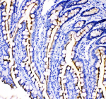 Immunohistochemical staining of MEP1B using anti-MEP1B antibody. MEP1B was detected in a paraffin-embedded section of rat intestine tissue. Heat mediated antigen retrieval was performed in EDTA buffer (pH 8.0, epitope retrieval solution). The tissue section was blocked with 10% goat serum. The tissue section was then incubated with 2 ug/ml rabbit anti-MEP1B antibody overnight at 4oC. Peroxidase Conjugated Goat Anti-rabbit IgG was used as secondary antibody and incubated for 30 minutes at 37oC. The tissue section was developed using an HRP secondary and DAB substrate.