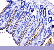 Immunohistochemical staining of MEP1B using anti-MEP1B antibody. MEP1B was detected in a paraffin-embedded section of mouse intestine tissue. Heat mediated antigen retrieval was performed in EDTA buffer (pH 8.0, epitope retrieval solution). The tissue section was blocked with 10% goat serum. The tissue section was then incubated with 2 ug/ml rabbit anti-MEP1B antibody overnight at 4oC. Peroxidase Conjugated Goat Anti-rabbit IgG was used as secondary antibody and incubated for 30 minutes at 37oC. The tissue section was developed using an HRP secondary and DAB substrate.