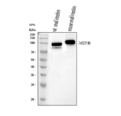Western blot analysis of MEP1B using anti-MEP1B antibody. Electrophoresis was performed on a 10% SDS-PAGE gel at 80V (Stacking gel) / 120V (Resolving gel) for 2-3 hours. Lane 1: rat small intestine tissue lysates, Lane 2: mouse small intestine tissue lysates. After electrophoresis, proteins were transferred to a nitrocellulose membrane at 150 mA for 50-90 minutes. Blocked the membrane with 5% non-fat milk/TBS for 1.5 hour at RT. The membrane was incubated with rabbit anti-MEP1B antibody at 0.5 ug/ml overnight at 4oC, then washed with TBS-0.1%Tween 3 times with 5 minutes each and probed with a goat anti-rabbit IgG-HRP secondary antibody at a dilution of 1:5000 for 1.5 hour at RT. The signal was developed using an ECL Plus Western Blotting Substrate. The expected molecular weight of MEP1B is ~80 kDa.