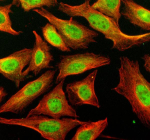 Immunofluorescent staining of SLX4 using anti-SLX4 antibody (green) and anti-Beta Tubulin antibody (red). SLX4 was detected in an immunocytochemical section of U2OS cells. Enzyme antigen retrieval was performed using IHC enzyme antigen retrieval reagent for 15 mins. The cells were blocked with 10% goat serum. And then incubated with 5 ug/ml rabbit anti-SLX4 antibody and mouse anti-Beta Tubulin antibody overnight at 4oC. DyLight 488 Conjugated Goat Anti-Rabbit IgG and Cy3 Conjugated Goat Anti-Mouse IgG were used as secondary antibody at 1:500 dilution and incubated for 30 minutes at 37oC. Visualize using a fluorescence microscope and filter sets appropriate for the label used.