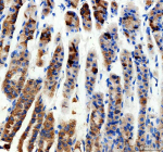 Immunohistochemical staining of RHOT2 using anti-RHOT2 antibody. RHOT2 was detected in a paraffin-embedded section of mouse stomach tissue. Heat mediated antigen retrieval was performed in EDTA buffer (pH 8.0, epitope retrieval solution). The tissue section was blocked with 10% goat serum. The tissue section was then incubated with 2 ug/ml rabbit anti-RHOT2 antibody overnight at 4oC. Peroxidase Conjugated Goat Anti-rabbit IgG was used as secondary antibody and incubated for 30 minutes at 37oC. The tissue section was developed using an HRP secondary and DAB substrate.