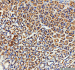 Immunohistochemical staining of RHOT2 using anti-RHOT2 antibody. RHOT2 was detected in a paraffin-embedded section of rat stomach tissue. Heat mediated antigen retrieval was performed in EDTA buffer (pH 8.0, epitope retrieval solution). The tissue section was blocked with 10% goat serum. The tissue section was then incubated with 2 ug/ml rabbit anti-RHOT2 antibody overnight at 4oC. Peroxidase Conjugated Goat Anti-rabbit IgG was used as secondary antibody and incubated for 30 minutes at 37oC. The tissue section was developed using an HRP secondary and DAB substrate.