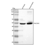 Western blot analysis of PACSIN1 using anti-PACSIN1 antibody. Lane 1: rat brain tissue lysates, Lane 2: mouse brain tissue lysates. After electrophoresis, proteins were transferred to a nitrocellulose membrane at 150 mA for 50-90 minutes. Blocked the membrane with 5% non-fat milk/TBS for 1.5 hour at RT. The membrane was incubated with rabbit anti-PACSIN1 antibody at 0.5 ug/ml overnight at 4oC, then washed with TBS-0.1%Tween 3 times with 5 minutes each and probed with a goat anti-rabbit IgG-HRP secondary antibody at a dilution of 1:5000 for 1.5 hour at RT. The signal was developed using enhanced chemiluminescent. The expected molecular weight of PACSIN1 is ~50 kDa.