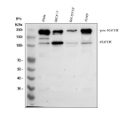 Western blot analysis of IGF1R using anti-IGF1R antibody. Lane 1: human Hela whole cell lysates, Lane 2: human MCF-7 whole cell lysates, Lane 3: human SH-SY5Y whole cell lysates, Lane 4: human whole cell lysates. After electrophoresis, proteins were transferred to a nitrocellulose membrane at 150 mA for 50-90 minutes. Blocked the membrane with 5% non-fat milk/TBS for 1.5 hour at RT. The membrane was incubated with rabbit anti-IGF1R antibody at 0.5 ug/ml overnight at 4oC, then washed with TBS-0.1%Tween 3 times with 5 minutes each and probed with a goat anti-rabbit IgG-HRP secondary antibody at a dilution of 1:5000 for 1.5 hour at RT. The signal was developed using enhanced chemiluminescent. Predicted molecular weight: ~200 kDa (pro), 120-130 kDa (alpha), 90-97 kDa (beta).