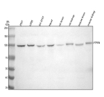 Western blot analysis of PTPRN using anti-PTPRN antibody. Electrophoresis was performed on a 8% SDS-PAGE gel at 80V (Stacking gel) / 120V (Resolving gel) for 2 hours. Lane 1: human 293T whole cell lysates, Lane 2: human U20S whole cell lysates, Lane 3: human SH-SY5Y whole cell lysates, Lane 4: human Hacat whole cell lysates, Lane 5: rat brain tissue lysates, Lane 6: rat kidney tissue lysates, Lane 7: mouse brain tissue lysates, Lane 8: mouse kidney tissue lysates. After electrophoresis, proteins were transferred to a nitrocellulose membrane at 150 mA for 50-90 minutes. Blocked the membrane with 5% non-fat milk/TBS for 1.5 hour at RT. The membrane was incubated with rabbit anti-PTPRN antibody at 0.5 ug/ml overnight at 4oC, then washed with TBS-0.1%Tween 3 times with 5 minutes each and probed with a goat anti-rabbit IgG-HRP secondary antibody at a dilution of 1:5000 for 1.5 hour at RT. The signal was developed using an ECL Plus Western Blotting Substrate. The expected molecular weight of PTPRN is 96-106 kDa (three isoforms).