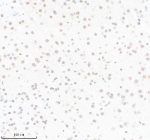 Immunohistochemical staining of PIK3CB using anti- PIK3CB antibody. PIK3CB was detected in a paraffin-embedded section of mouse brain tissue. Heat mediated antigen retrieval was performed in EDTA buffer (pH 8.0, epitope retrieval solution). The tissue section was blocked with 10% goat serum. The tissue section was then incubated with 1: 50 rabbit anti- PIK3CB antibody overnight at 4oC. Peroxidase Conjugated Goat Anti-rabbit IgG was used as secondary antibody and incubated for 30 minutes at 37oC. The tissue section was developed using an HRP secondary and DAB substrate.
