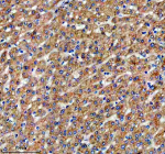 Immunohistochemical staining of SIGIRR using anti-SIGIRR antibody. SIGIRR was detected in a paraffin-embedded section of human liver tissue. Heat mediated antigen retrieval was performed in EDTA buffer (pH 8.0, epitope retrieval solution). The tissue section was blocked with 10% goat serum. The tissue section was then incubated with 2 ug/ml rabbit anti-SIGIRR antibody overnight at 4oC. Peroxidase Conjugated Goat Anti-rabbit IgG was used as secondary antibody and incubated for 30 minutes at 37oC. The tissue section was developed using an HRP secondary and DAB substrate.