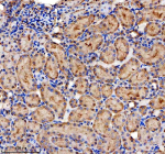 Immunohistochemical staining of SIGIRR using anti-SIGIRR antibody. SIGIRR was detected in a paraffin-embedded section of rat kidney tissue. Heat mediated antigen retrieval was performed in EDTA buffer (pH 8.0, epitope retrieval solution). The tissue section was blocked with 10% goat serum. The tissue section was then incubated with 2 ug/ml rabbit anti-SIGIRR antibody overnight at 4oC. Peroxidase Conjugated Goat Anti-rabbit IgG was used as secondary antibody and incubated for 30 minutes at 37oC. The tissue section was developed using an HRP secondary and DAB substrate.