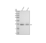 Western blot analysis of Gp9 using anti-Gp9 antibody. Electrophoresis was performed on a 12% SDS-PAGE gel at 80V (Stacking gel) / 120V (Resolving gel) for 2 hours. Lane 1: rat spleen tissue lysates, Lane 2: rat lung tissue lysates. After electrophoresis, proteins were transferred to a nitrocellulose membrane at 150 mA for 50-90 minutes. Blocked the membrane with 5% non-fat milk/TBS for 1.5 hour at RT. The membrane was incubated with rabbit anti-Gp9 antibody at 0.5 ug/ml overnight at 4oC, then washed with TBS-0.1%Tween 3 times with 5 minutes each and probed with a goat anti-rabbit IgG-HRP secondary antibody at a dilution of 1:5000 for 1.5 hour at RT. The signal was developed using an ECL Plus Western Blotting Substrate. The expected molecular weight of Gp9 is ~19 kDa.