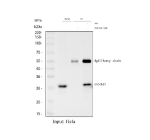 Immunoprecipitation of NNMT protein from 500ug of human HeLa whole cell lysate with 2ug of NNMT antibody.