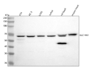 Western blot analysis of SLC14A1 using anti-SLC14A1 antibody. Lane 1: human RT4 whole cell lysates, Lane 2: human PC-3 whole cell lysates, Lane 3: human U20S whole cell lysates, Lane 4: human Jurkat whole cell lysates, Lane 5: rat heart tissue lysates, Lane 6: mouse heart tissue lysates. After electrophoresis, proteins were transferred to a nitrocellulose membrane at 150 mA for 50-90 minutes. Blocked the membrane with 5% non-fat milk/TBS for 1.5 hour at RT. The membrane was incubated with rabbit anti-SLC14A1 antibody at 0.5 ug/ml overnight at 4oC, then washed with TBS-0.1%Tween 3 times with 5 minutes each and probed with a goat anti-rabbit IgG-HRP secondary antibody at a dilution of 1:5000 for 1.5 hour at RT. The signal was developed using enhanced chemiluminescent. SLC14A1 (UT-B) may be detected at ~65 kDa-above the ~43 kDa predicted size-consistent with the documented N-linked glycosylation and isoform heterogeneity of the protein.