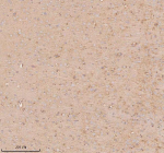 Immunohistochemical staining of SLC14A1 using anti-SLC14A1 antibody. SLC14A1 was detected in a paraffin-embedded section of rat brain tissue. Heat mediated antigen retrieval was performed in EDTA buffer (pH 8.0, epitope retrieval solution). The tissue section was blocked with 10% goat serum. The tissue section was then incubated with 2 ug/ml rabbit anti-SLC14A1 antibody overnight at 4oC. Peroxidase Conjugated Goat Anti-rabbit IgG was used as secondary antibody and incubated for 30 minutes at 37oC. The tissue section was developed using an HRP secondary and DAB substrate.