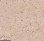 Immunohistochemical staining of SLC14A1 using anti-SLC14A1 antibody. SLC14A1 was detected in a paraffin-embedded section of rat brain tissue. Heat mediated antigen retrieval was performed in EDTA buffer (pH 8.0, epitope retrieval solution). The tissue section was blocked with 10% goat serum. The tissue section was then incubated with 2 ug/ml rabbit anti-SLC14A1 antibody overnight at 4oC. Peroxidase Conjugated Goat Anti-rabbit IgG was used as secondary antibody and incubated for 30 minutes at 37oC. The tissue section was developed using an HRP secondary and DAB substrate.