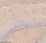 Immunohistochemical staining of SLC14A1 using anti-SLC14A1 antibody. SLC14A1 was detected in a paraffin-embedded section of rat brain tissue. Heat mediated antigen retrieval was performed in EDTA buffer (pH 8.0, epitope retrieval solution). The tissue section was blocked with 10% goat serum. The tissue section was then incubated with 2 ug/ml rabbit anti-SLC14A1 antibody overnight at 4oC. Peroxidase Conjugated Goat Anti-rabbit IgG was used as secondary antibody and incubated for 30 minutes at 37oC. The tissue section was developed using an HRP secondary and DAB substrate.