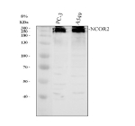 Western blot analysis of NCOR2 using anti-NCOR2 antibody. Electrophoresis was performed on a 8% SDS-PAGE gel at 80V (Stacking gel) / 120V (Resolving gel) for 2 hours. Lane 1: human PC-3 whole cell lysates, Lane 2: human whole cell lysates. After electrophoresis, proteins were transferred to a nitrocellulose membrane at 150 mA for 50-90 minutes. Blocked the membrane with 5% non-fat milk/TBS for 1.5 hour at RT. The membrane was incubated with rabbit anti-NCOR2 antibody at 0.5 ug/ml overnight at 4oC, then washed with TBS-0.1%Tween 3 times with 5 minutes each and probed with a goat anti-rabbit IgG-HRP secondary antibody at a dilution of 1:5000 for 1.5 hour at RT. The signal is developed using an ECL Plus Western Blotting Substrate with Tanon 5200 system. Predicted molecular weight: 267-274 kDa, ~81 kDa (multiple isoforms).