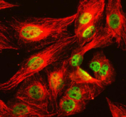 Immunofluorescent staining of NCOR2 using anti-NCOR2 antibody (green) and anti-Tubulin Alpha antibody (red). NCOR2 was detected in immunocytochemical section of U2OS cell. Enzyme antigen retrieval was performed using IHC enzyme antigen retrieval reagent for 15 mins. The cells were blocked with 10% goat serum. And then incubated with 5 ug/ml rabbit anti-NCOR2 antibody and mouse anti-Tubulin Alpha antibody overnight at 4oC. DyLight 488 Conjugated Goat Anti-Rabbit IgG and Cy3 Conjugated Goat Anti-Mouse IgG were used as secondary antibody at 1:500 dilution and incubated for 30 minutes at 37oC. Visualize using a fluorescence microscope and filter sets appropriate for the label used.