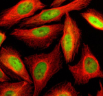 Immunofluorescent staining of SLF2 using anti-SLF2 antibody (green) and anti-Beta Tubulin antibody (red). SLF2 was detected in an immunocytochemical section of U2OS cells. Enzyme antigen retrieval was performed using IHC enzyme antigen retrieval reagent for 15 mins. The cells were blocked with 10% goat serum. And then incubated with 5 ug/ml rabbit anti-SLF2 antibody and mouse anti-Beta Tubulin antibody overnight at 4oC. DyLight 488 Conjugated Goat Anti-Rabbit IgG and Cy3 Conjugated Goat Anti-Mouse IgG were used as secondary antibody at 1:500 dilution and incubated for 30 minutes at 37oC. Visualize using a fluorescence microscope and filter sets appropriate for the label used.