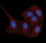 Immunofluorescent staining of LYAR using anti-LYAR antibody (green) and anti-Beta Tubulin antibody (red). LYAR was detected in immunocytochemical section of human HeLa cells. Enzyme antigen retrieval was performed using IHC enzyme antigen retrieval reagent for 15 mins. The cells were blocked with 10% goat serum. And then incubated with 5 ug/ml rabbit anti-LYAR antibody and mouse anti-Beta Tubulin antibody overnight at 4oC. DyLight 488 Conjugated Goat Anti-Rabbit IgG and Cy3 Conjugated Goat Anti-Mouse IgG were used as secondary antibody at 1:500 dilution and incubated for 30 minutes at 37oC. The section was counterstained with DAPI nuclear stain (blue). Visualize using a fluorescence microscope and filter sets appropriate for the label used.