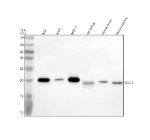 Western blot analysis of GGCT using anti-GGCT antibody. Electrophoresis was performed on a 12% SDS-PAGE gel at 80V (Stacking gel) / 120V (Resolving gel) for 2 hours. Lane 1: human RT4 whole cell lysates, Lane 2: human whole cell lysates, Lane 3: human MCF-7 whole cell lysates, Lane 4: rat kidney tissue lysates, Lane 5: mouse brain tissue lysates, Lane 6: mouse kidney tissue lysates. After electrophoresis, proteins were transferred to a nitrocellulose membrane at 150 mA for 50-90 minutes. Blocked the membrane with 5% non-fat milk/TBS for 1.5 hour at RT. The membrane was incubated with rabbit anti-GGCT antibody at 0.5 ug/ml overnight at 4oC, then washed with TBS-0.1%Tween 3 times with 5 minutes each and probed with a goat anti-rabbit IgG-HRP secondary antibody at a dilution of 1:5000 for 1.5 hour at RT. The signal was developed using an ECL Plus Western Blotting Substrate. The expected molecular weight of GGCT is ~21 kDa.