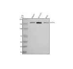 Western blot analysis of ATP7A using anti-ATP7A antibody. Lane 1: human HepG2 whole cell lysates, Lane 2: human SH-SY5Y whole cell lysates, Lane 3: human K562 whole cell lysates. After electrophoresis, proteins were transferred to a nitrocellulose membrane at 150 mA for 50-90 minutes. Blocked the membrane with 5% non-fat milk/TBS for 1.5 hour at RT. The membrane was incubated with rabbit anti-ATP7A antibody at 0.5 ug/ml overnight at 4oC, then washed with TBS-0.1%Tween 3 times with 5 minutes each and probed with a goat anti-rabbit IgG-HRP secondary antibody at a dilution of 1:5000 for 1.5 hour at RT. The signal was developed using enhanced chemiluminescent. The expected molecular weight of ATP7A is ~163 kDa.