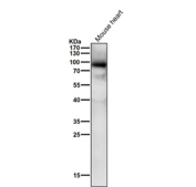 All lanes use the Phospho-PKC alpha (Thr497) antibody at 1:1K dilution for 1 hour at room temperature.