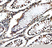 Immunohistochemical staining of SHMT2 using anti-SHMT2 antibody. SHMT2 was detected in a paraffin-embedded section of human colon tissue. Heat mediated antigen retrieval was performed in EDTA buffer (pH 8.0, epitope retrieval solution). The tissue section was blocked with 10% goat serum. The tissue section was then incubated with 2 ug/ml rabbit anti-SHMT2 antibody overnight at 4oC. Peroxidase Conjugated Goat Anti-rabbit IgG was used as secondary antibody and incubated for 30 minutes at 37oC. The tissue section was developed using an HRP secondary and DAB substrate.