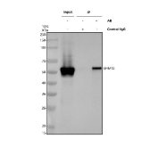 Immunoprecipitation of SHMT2 protein from 500ug of human 293T whole cell lysate with 2ug of SHMT2 antibody.