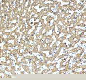 Immunohistochemical staining of SHMT2 using anti-SHMT2 antibody. SHMT2 was detected in a paraffin-embedded section of human liver tissue. Heat mediated antigen retrieval was performed in EDTA buffer (pH 8.0, epitope retrieval solution). The tissue section was blocked with 10% goat serum. The tissue section was then incubated with 2 ug/ml rabbit anti-SHMT2 antibody overnight at 4oC. Peroxidase Conjugated Goat Anti-rabbit IgG was used as secondary antibody and incubated for 30 minutes at 37oC. The tissue section was developed using an HRP secondary and DAB substrate.