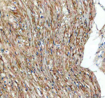 Immunohistochemical staining of TGFBI using anti-TGFBI antibody. TGFBI was detected in a paraffin-embedded section of human intestinal smooth muscle tissue. Heat mediated antigen retrieval was performed in EDTA buffer (pH 8.0, epitope retrieval solution). The tissue section was blocked with 10% goat serum. The tissue section was then incubated with 2 ug/ml rabbit anti-TGFBI antibody overnight at 4oC. Peroxidase Conjugated Goat Anti-rabbit IgG was used as secondary antibody and incubated for 30 minutes at 37oC. The tissue section was developed using an HRP secondary and DAB substrate.