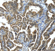 Immunohistochemical staining of STRBP using anti-STRBP antibody. STRBP was detected in a paraffin-embedded section of mouse brain tissue. Heat mediated antigen retrieval was performed in EDTA buffer (pH 8.0, epitope retrieval solution). The tissue section was blocked with 10% goat serum. The tissue section was then incubated with 2 ug/ml rabbit anti-STRBP antibody overnight at 4oC. Peroxidase Conjugated Goat Anti-rabbit IgG was used as secondary antibody and incubated for 30 minutes at 37oC. The tissue section was developed using an HRP secondary and DAB substrate.